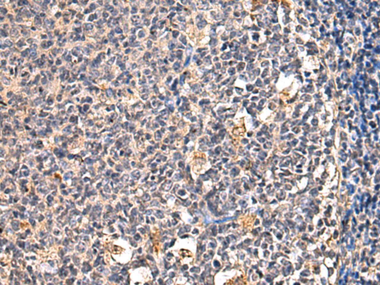 Immunohistochemistry of paraffin-embedded Human tonsil tissue  using ENTPD1 Polyclonal Antibody at dilution of 1:60(×200)