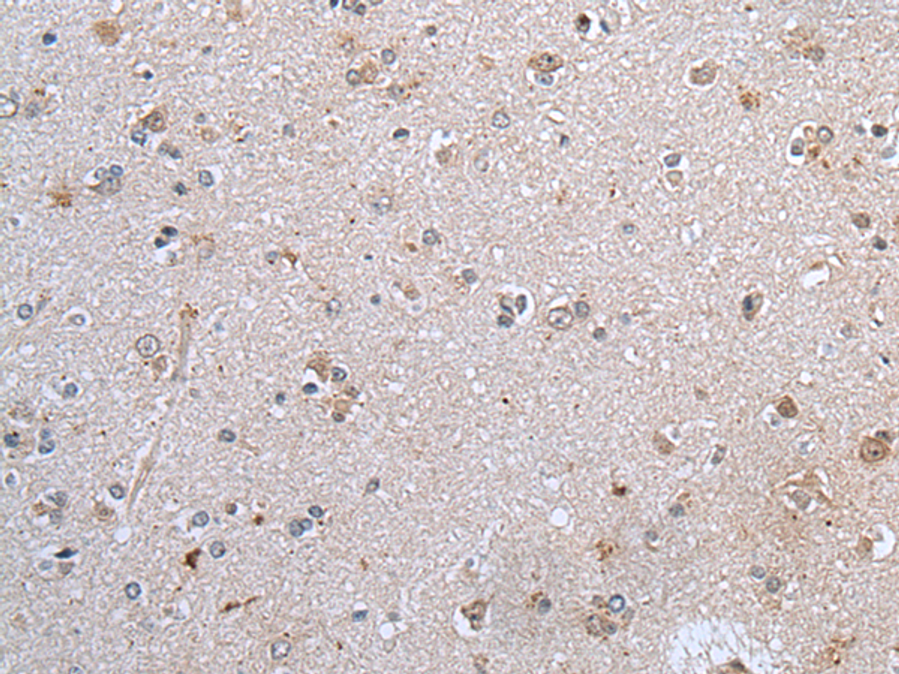Immunohistochemistry of paraffin-embedded Human brain tissue  using CLDN12 Polyclonal Antibody at dilution of 1:45(×200)