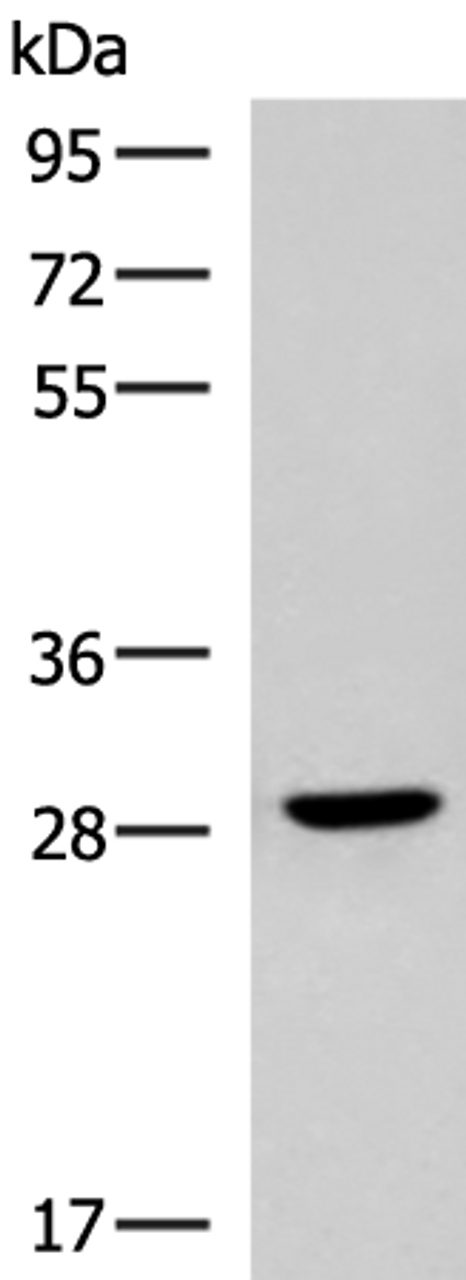 Western blot analysis of Human fetal brain tissue lysate  using CLEC9A Polyclonal Antibody at dilution of 1:800