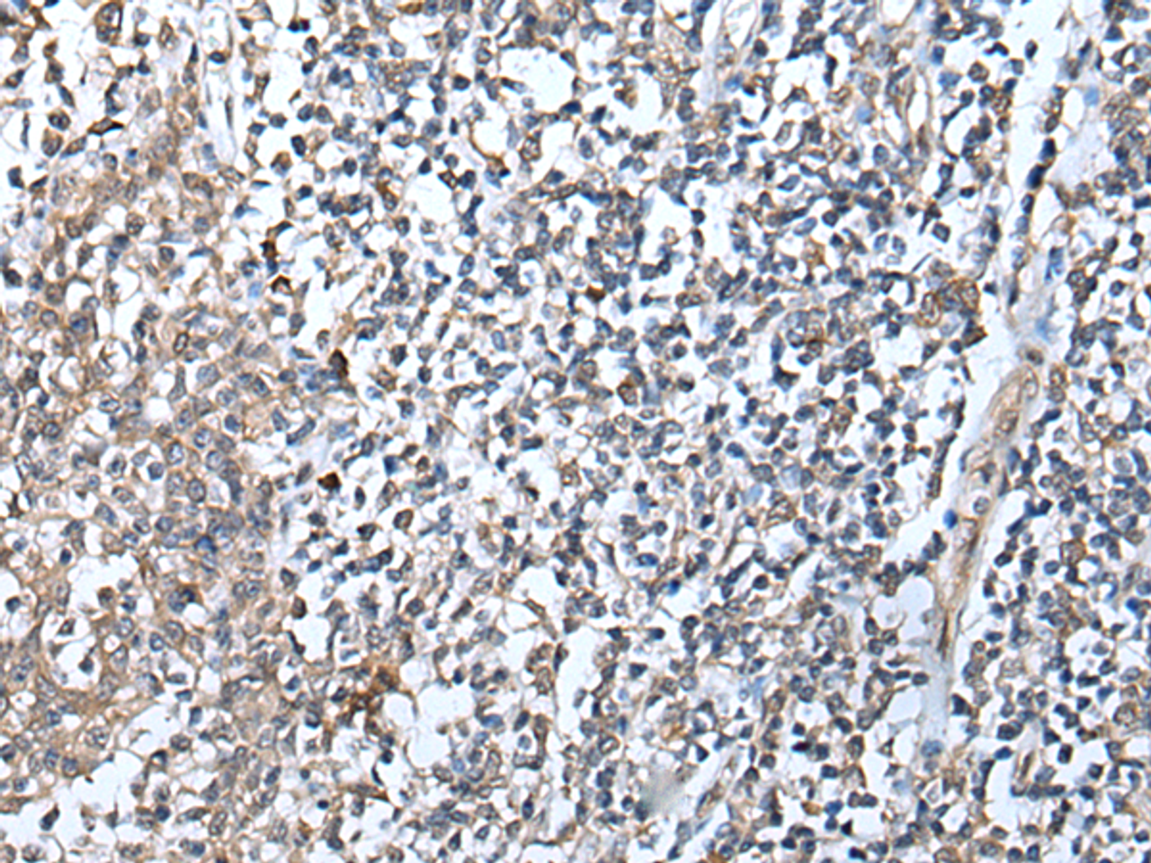 Immunohistochemistry of paraffin-embedded Human tonsil tissue  using DEFB104A Polyclonal Antibody at dilution of 1:50(×200)