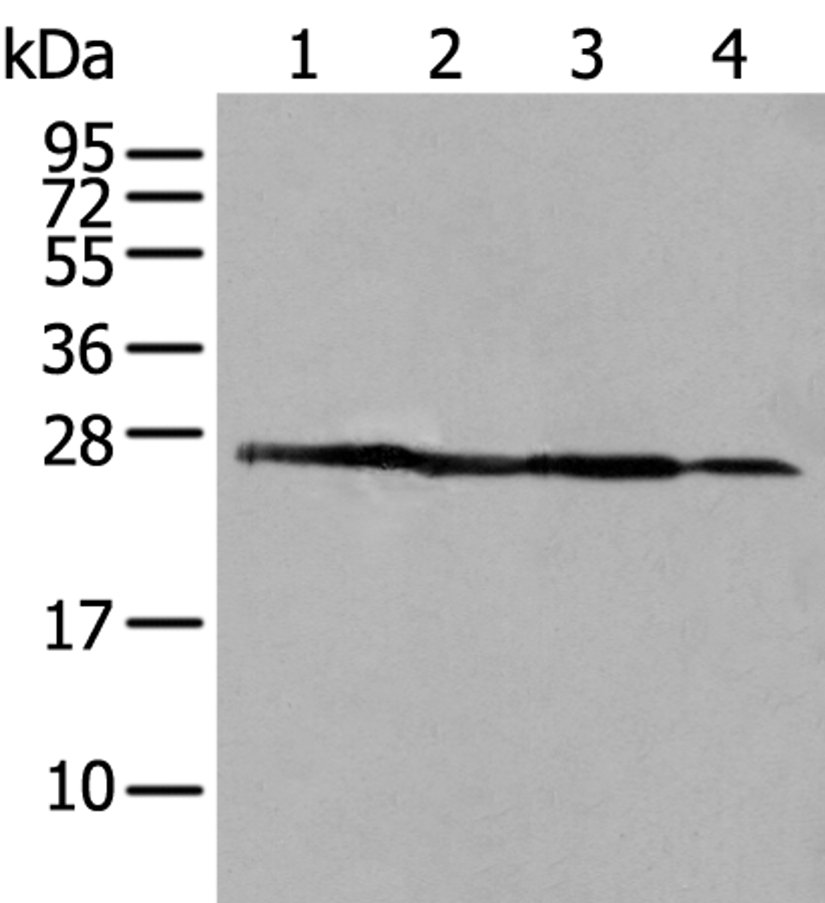 Western blot analysis of 293T A431 and HepG2 cell lysates  using ARHGDIB Polyclonal Antibody at dilution of 1:500