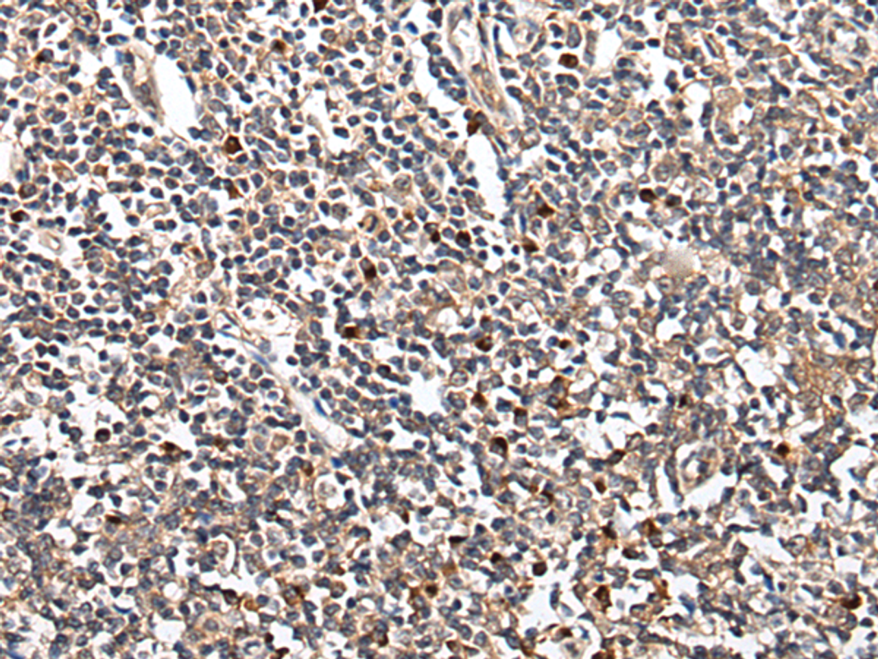 Immunohistochemistry of paraffin-embedded Human tonsil tissue  using HOXB9 Polyclonal Antibody at dilution of 1:45(×200)