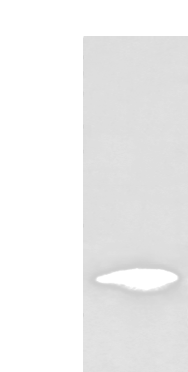 Western blot analysis of HL-60 cell lysate  using FSHB Polyclonal Antibody at dilution of 1:350