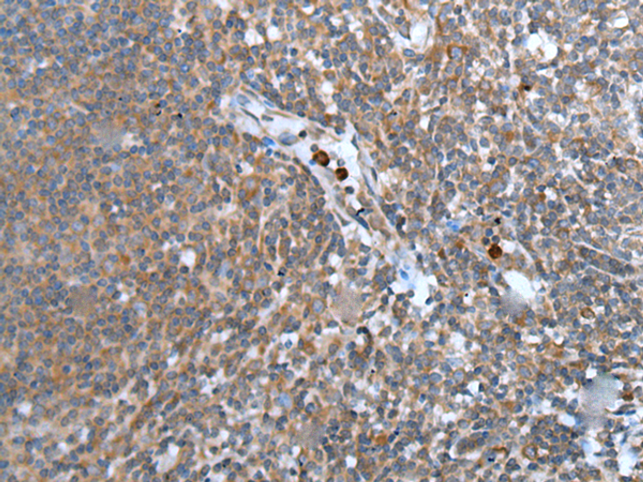 Immunohistochemistry of paraffin-embedded Human tonsil tissue  using WISP2 Polyclonal Antibody at dilution of 1:45(×200)
