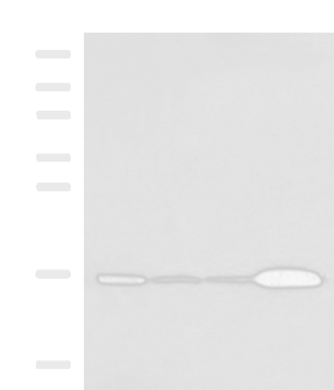 Western blot analysis of Mouse brain tissue Hela cell LNCAP cell HepG2 cell Jurkat cell lysates  using UBE2N Polyclonal Antibody at dilution of 1:800