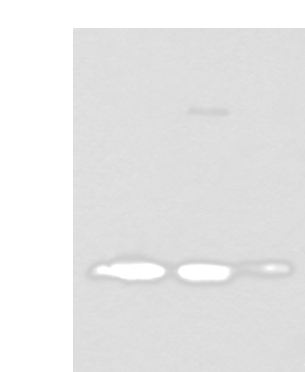 Western blot analysis of Rat brain tissue Human cerebrum tissue Human cerebella tissue lysates  using SNCB Polyclonal Antibody at dilution of 1:450