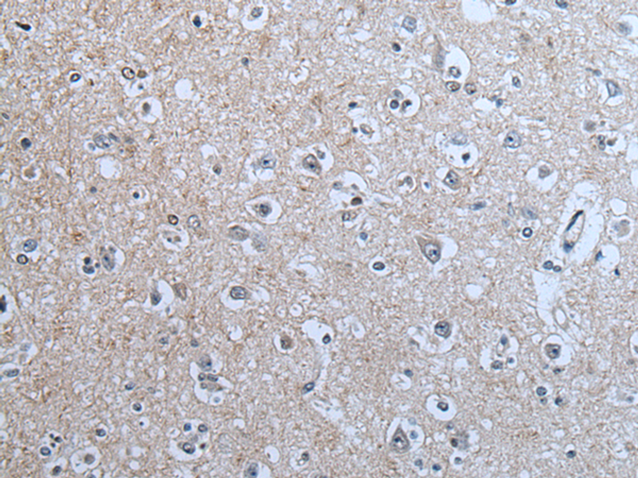 Immunohistochemistry of paraffin-embedded Human brain tissue  using BRSK2 Polyclonal Antibody at dilution of 1:70(×200)