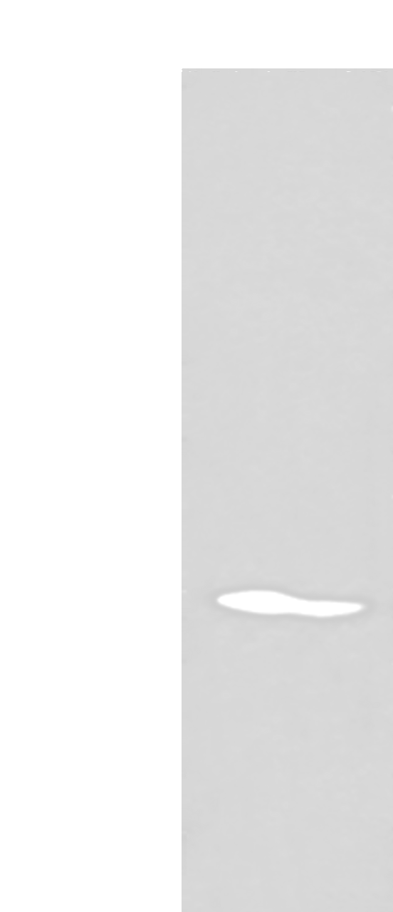 Western blot analysis of K562 cell lysate  using ARL1 Polyclonal Antibody at dilution of 1:550