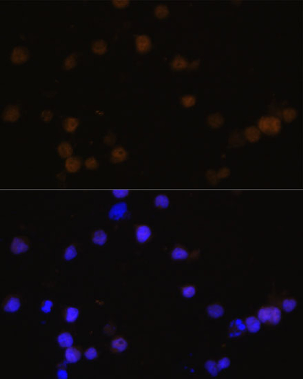 Immunofluorescence analysis of Y79 cells using Rb Polyclonal Antibody at dilution of  1:100 (40x lens). Blue: DAPI for nuclear staining.