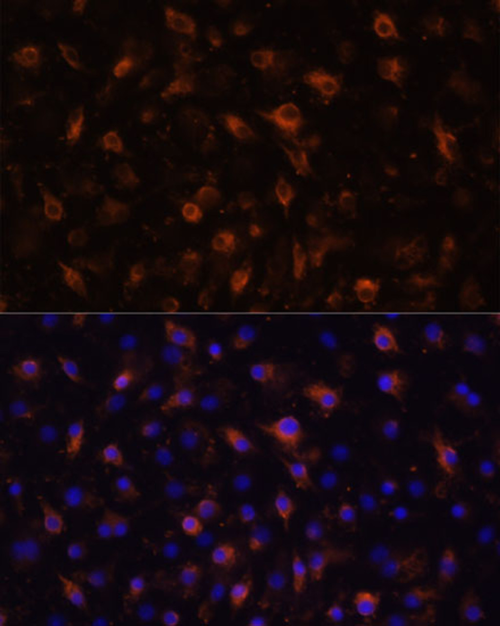 Immunofluorescence analysis of RAW264.7 cells using TLR4 Polyclonal Antibody at dilution of  1:100 (40x lens). Blue: DAPI for nuclear staining.