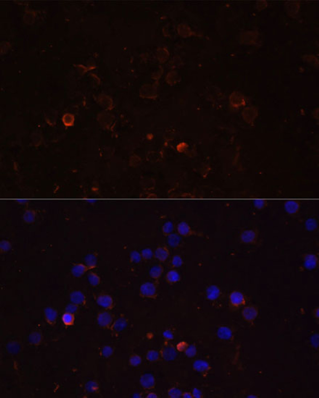 Immunofluorescence analysis of THP-1 cells using TLR4 Polyclonal Antibody at dilution of  1:100 (40x lens). Blue: DAPI for nuclear staining.