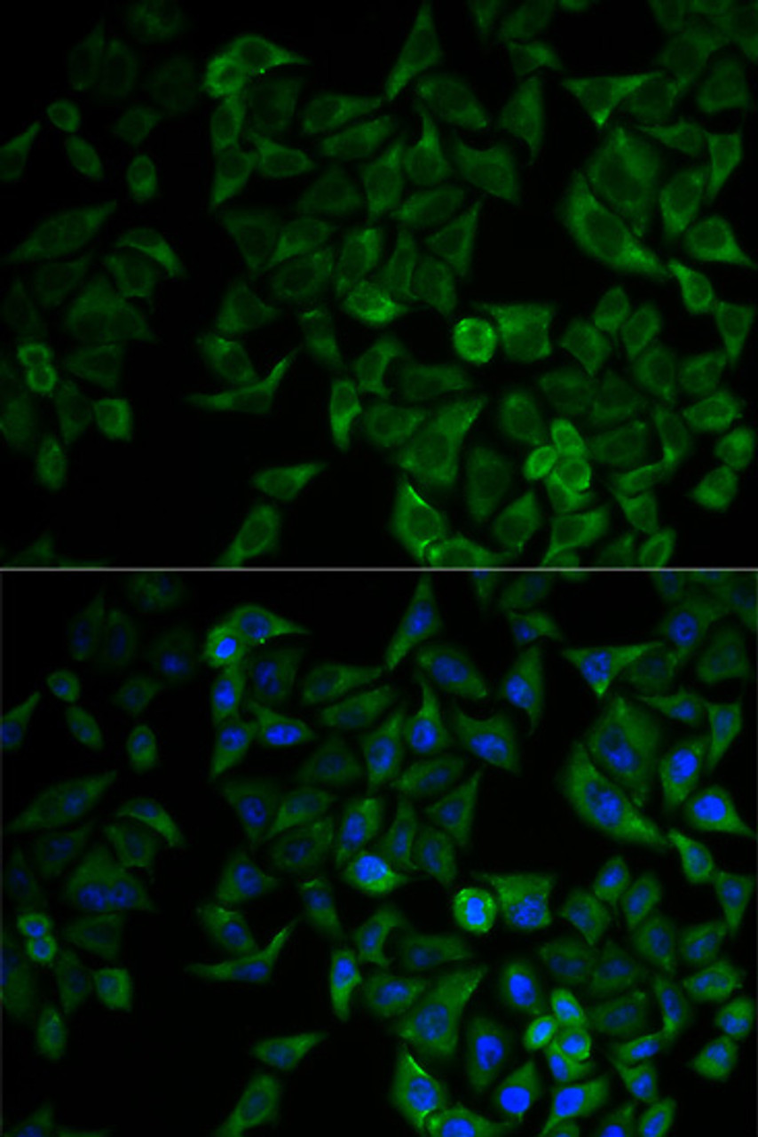 Immunofluorescence analysis of HeLa cells using TNFRSF1A Polyclonal Antibody