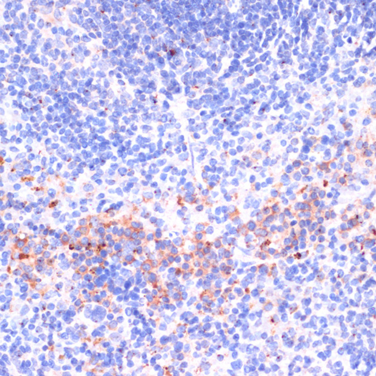 Immunohistochemistry of paraffin-embedded Mouse spleen using Perforin Polyclonal Antibody at dilution of  1:100 (40x lens).
