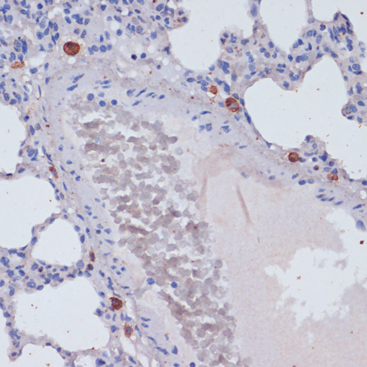 Immunohistochemistry of paraffin-embedded Rat lung using Perforin Polyclonal Antibody at dilution of  1:100 (40x lens).