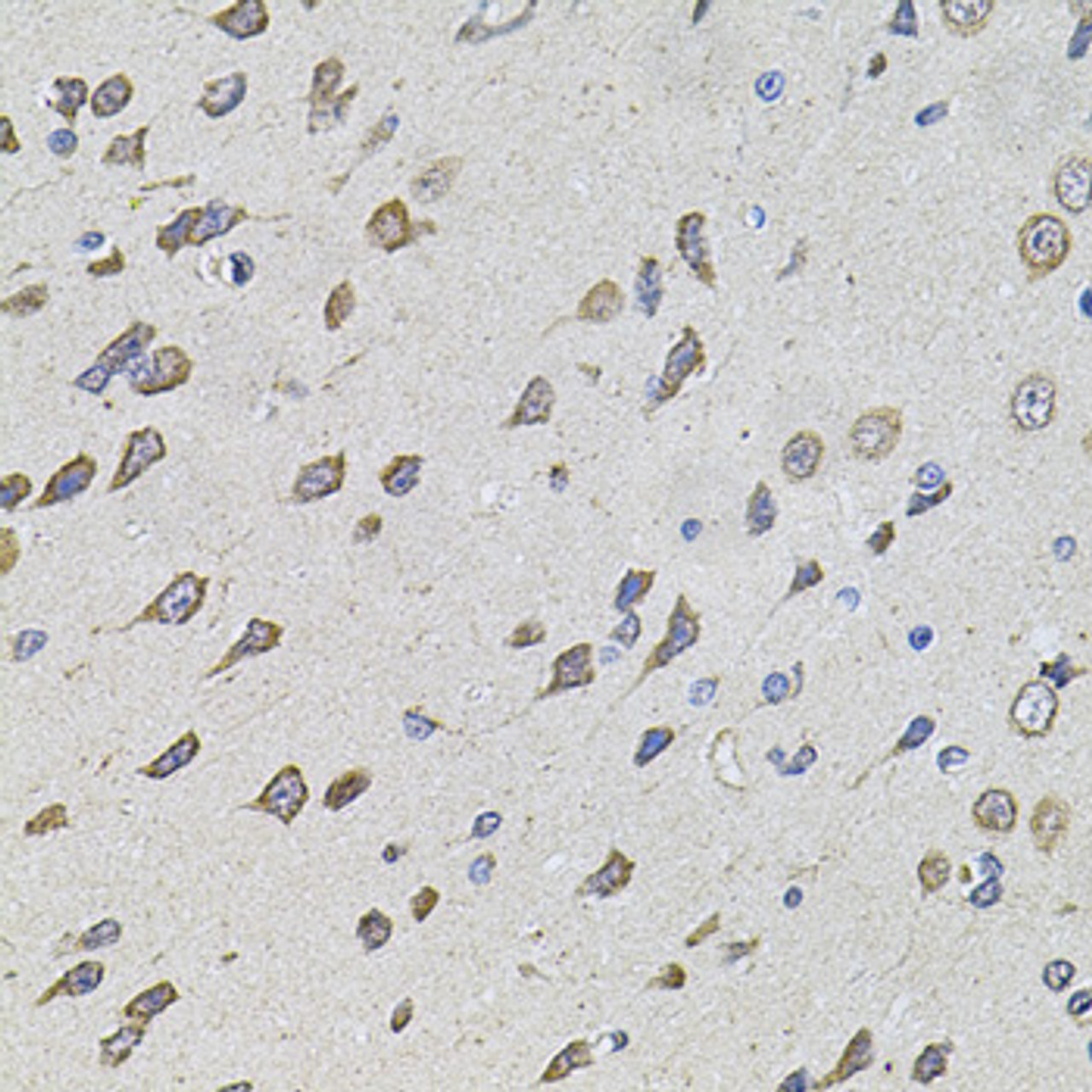 Immunohistochemistry of paraffin-embedded Rat brain using FoxO3a Polyclonal Antibody at dilution of  1:100 (40x lens).