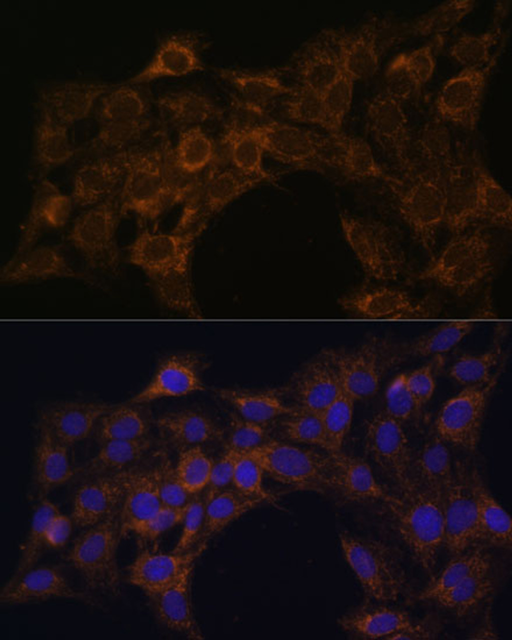Immunofluorescence analysis of C6 cells using FoxO3a Polyclonal Antibody at dilution of  1:100. Blue: DAPI for nuclear staining.