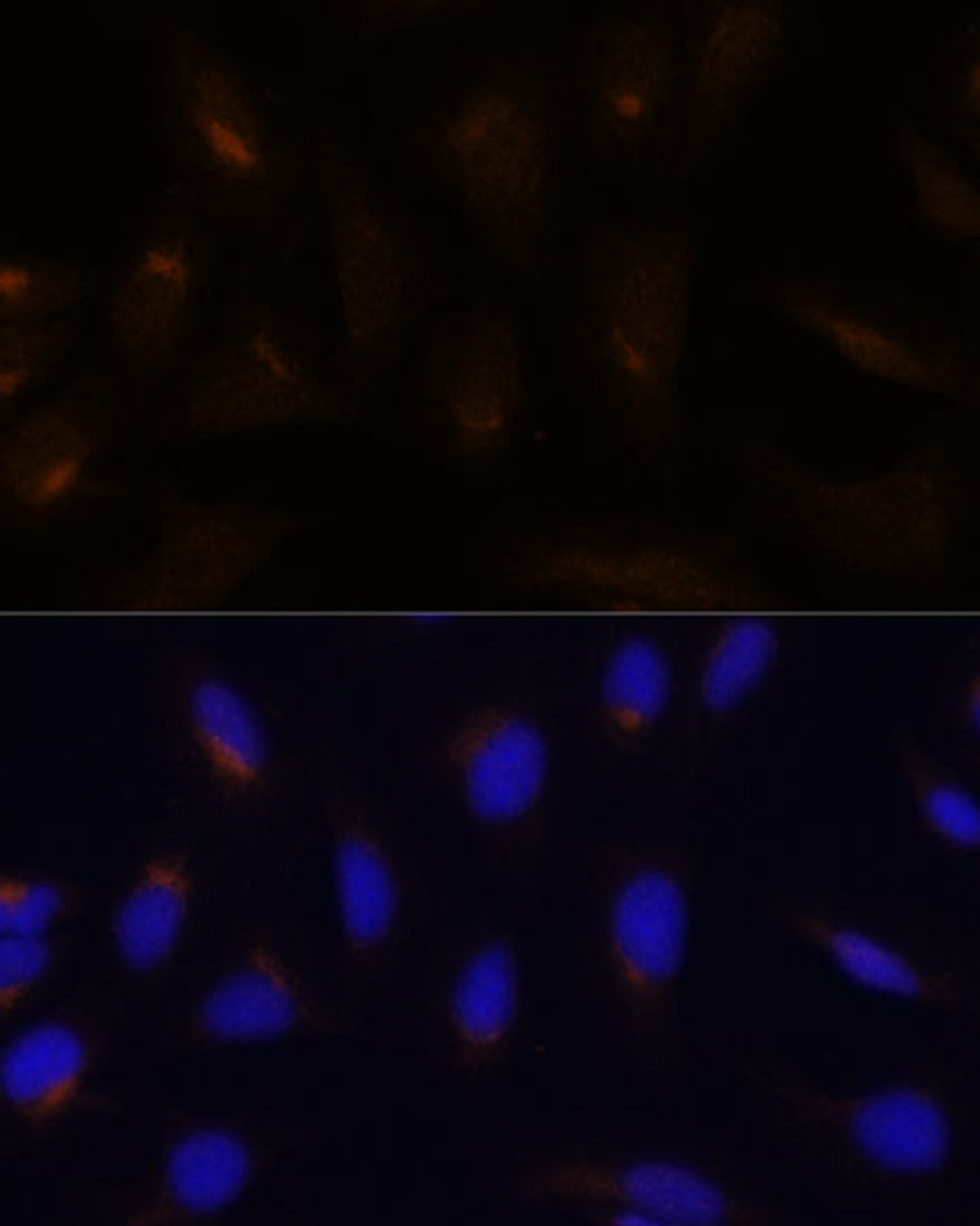 Immunofluorescence analysis of U-2 OS cells using FoxO3a Polyclonal Antibody at dilution of  1:100. Blue: DAPI for nuclear staining.