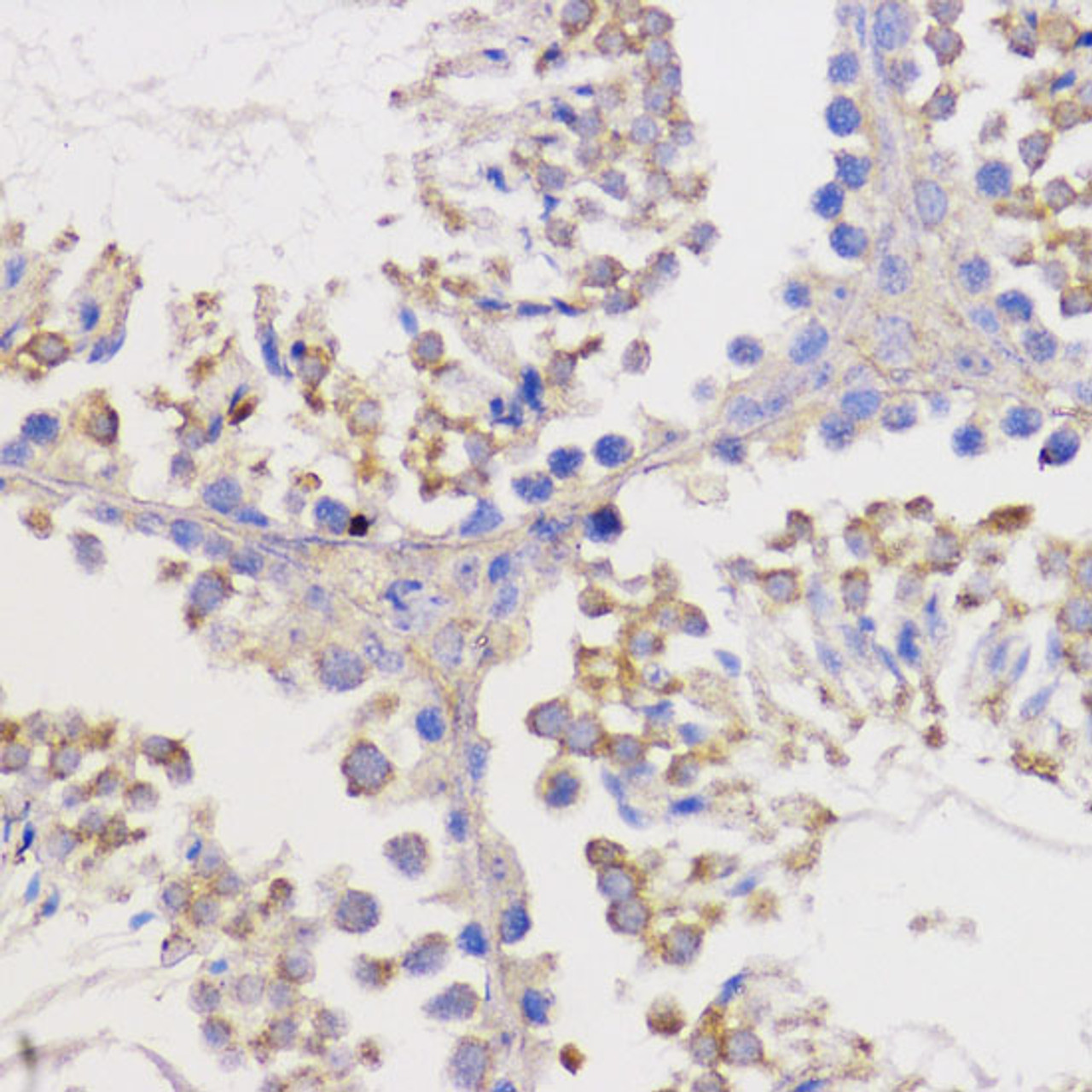 Immunohistochemistry of paraffin-embedded Mouse testis using Bcl-2 Polyclonal Antibody at dilution of  1:100 (40x lens).