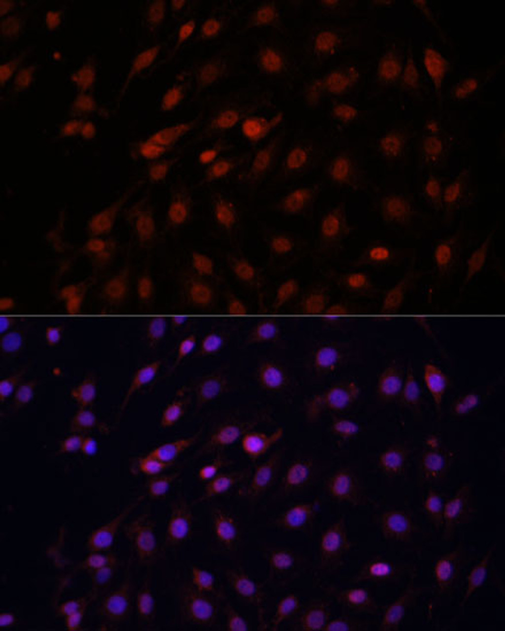 Immunofluorescence analysis of C6 cells using Bcl-2 Polyclonal Antibody at dilution of  1:100 (40x lens). Blue: DAPI for nuclear staining.
