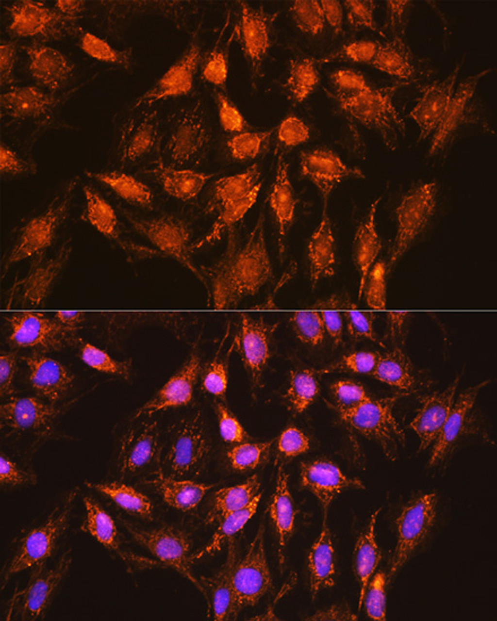 Immunofluorescence analysis of C6 cells using BCL2L1 Polyclonal Antibody at dilution of  1:100 (40x lens). Blue: DAPI for nuclear staining.
