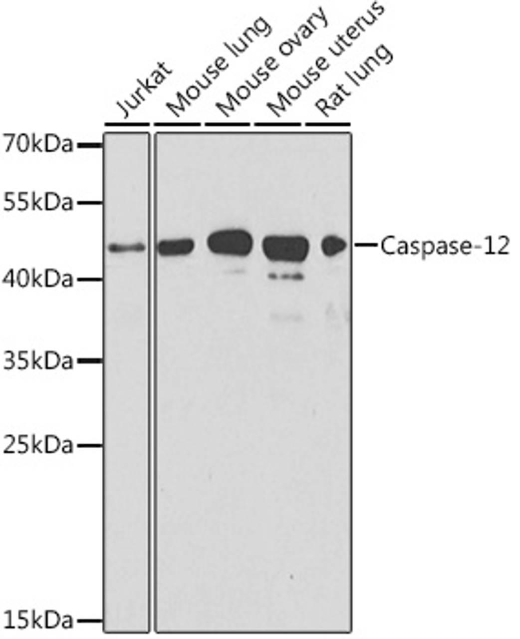 Western blot analysis of extracts of various cell lines using Caspase-12 Polyclonal Antibody at dilution of 1:1000.