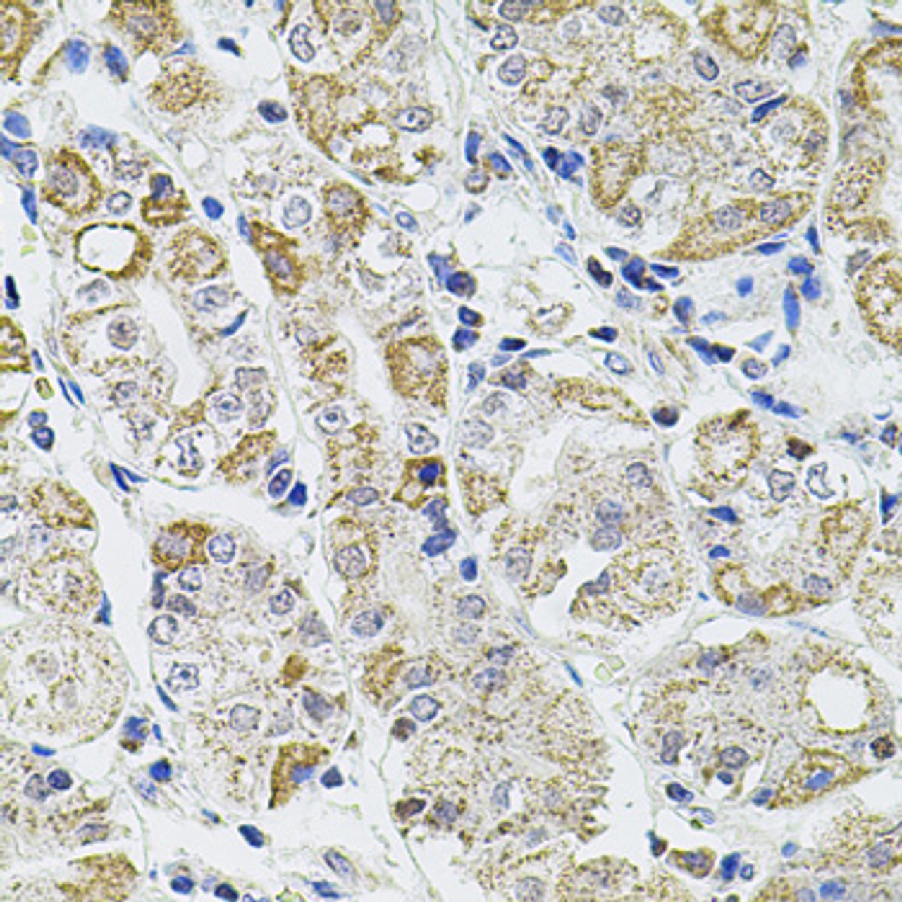 Immunohistochemistry of paraffin-embedded Human stomach using Caspase-12 Polyclonal Antibody at dilution of  1:100 (40x lens).