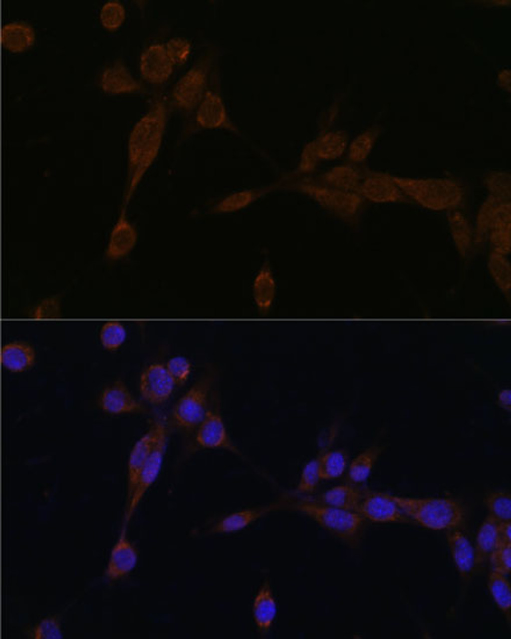 Immunofluorescence analysis of NIH-3T3 cells using Caspase-12 Polyclonal Antibody at dilution of  1:100 (40x lens). Blue: DAPI for nuclear staining.