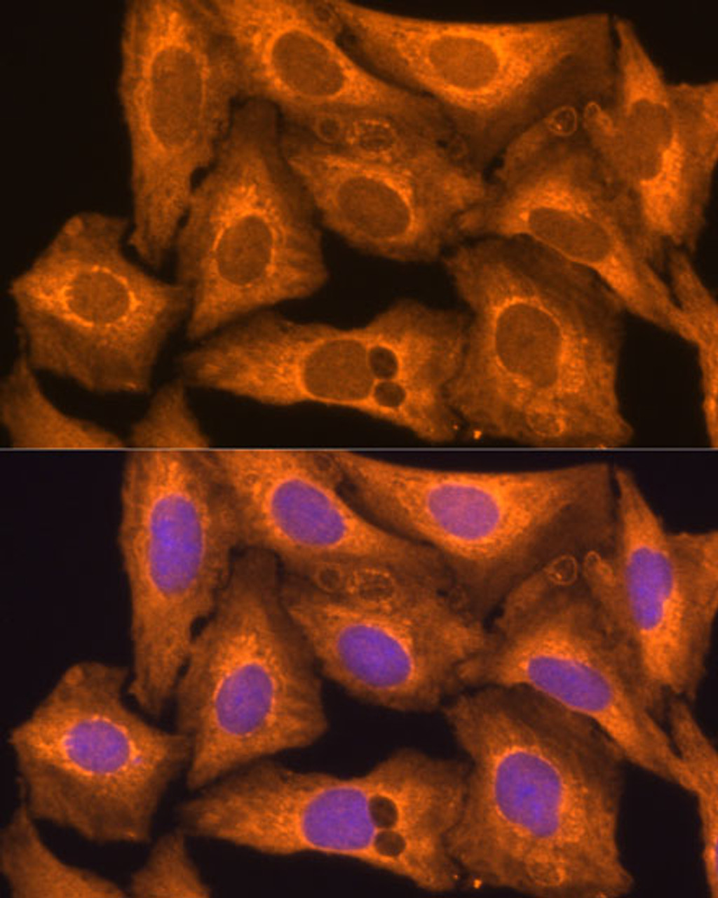 Immunofluorescence analysis of U-2 OS cells using Caspase-12 Polyclonal Antibody at dilution of  1:100 (40x lens). Blue: DAPI for nuclear staining.