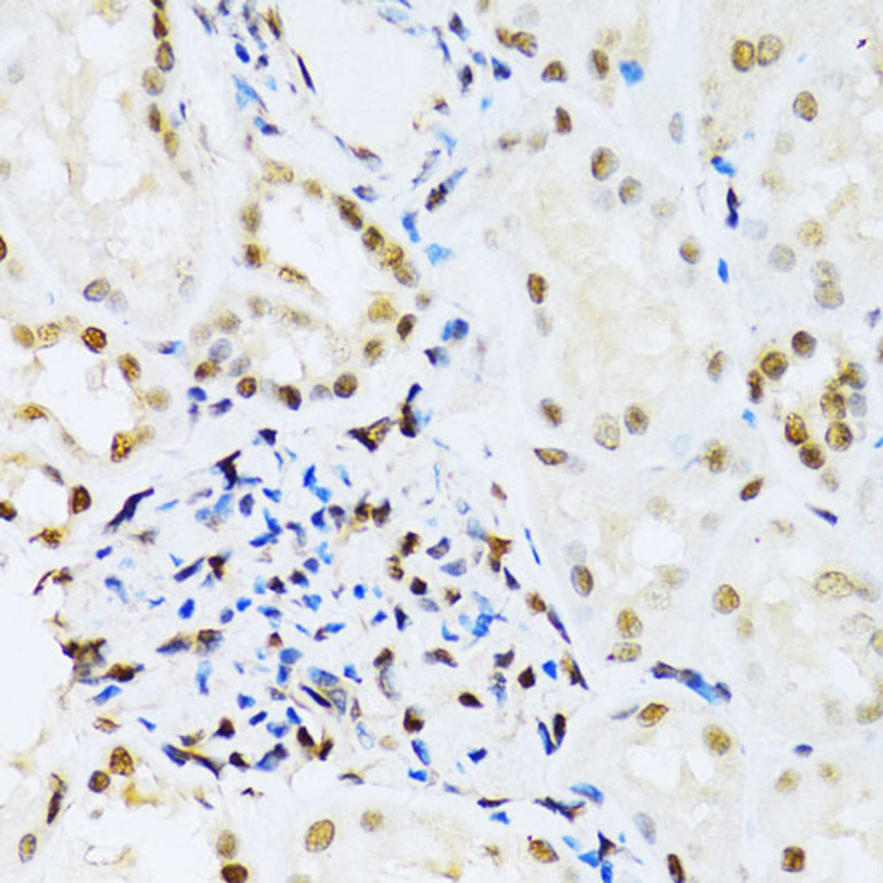 Immunohistochemistry of paraffin-embedded Human kidney using MAPK3 Polyclonal Antibody at dilution of  1:100 (40x lens).