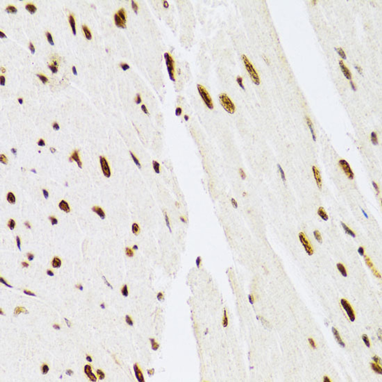 Immunohistochemistry of paraffin-embedded Mouse heart using MAPK3 Polyclonal Antibody at dilution of  1:100 (40x lens).