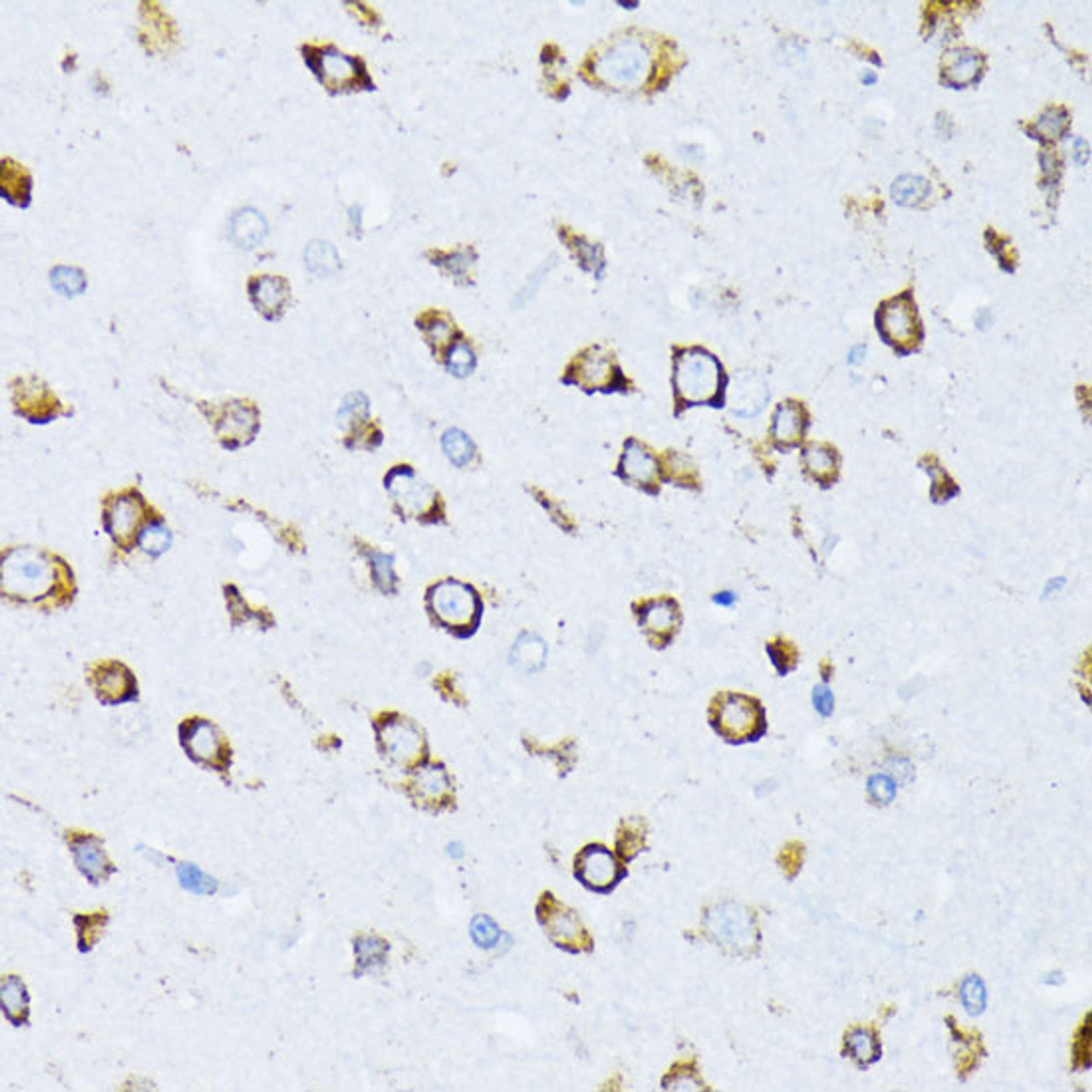 Immunohistochemistry of paraffin-embedded Rat brain using GRP78 / BiP Polyclonal Antibody at dilution of  1:100 (40x lens).