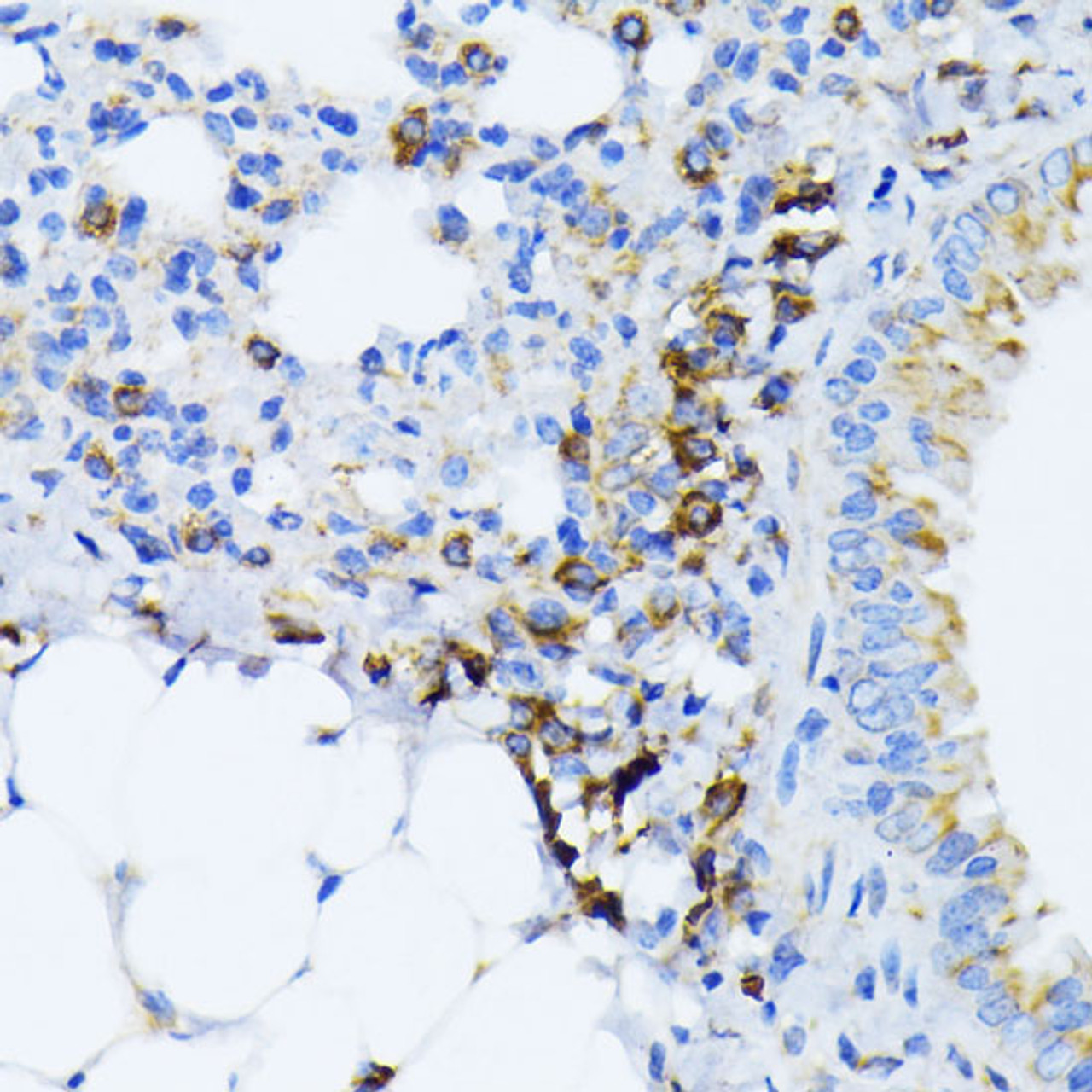 Immunohistochemistry of paraffin-embedded Mouse lung using GRP78 / BiP Polyclonal Antibody at dilution of  1:100 (40x lens).
