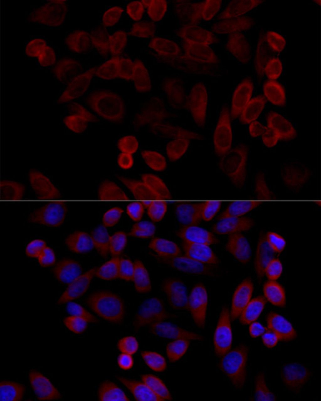 Immunofluorescence analysis of HeLa cells using GRP78 / BiP Polyclonal Antibody at dilution of  1:100 (40x lens). Blue: DAPI for nuclear staining.