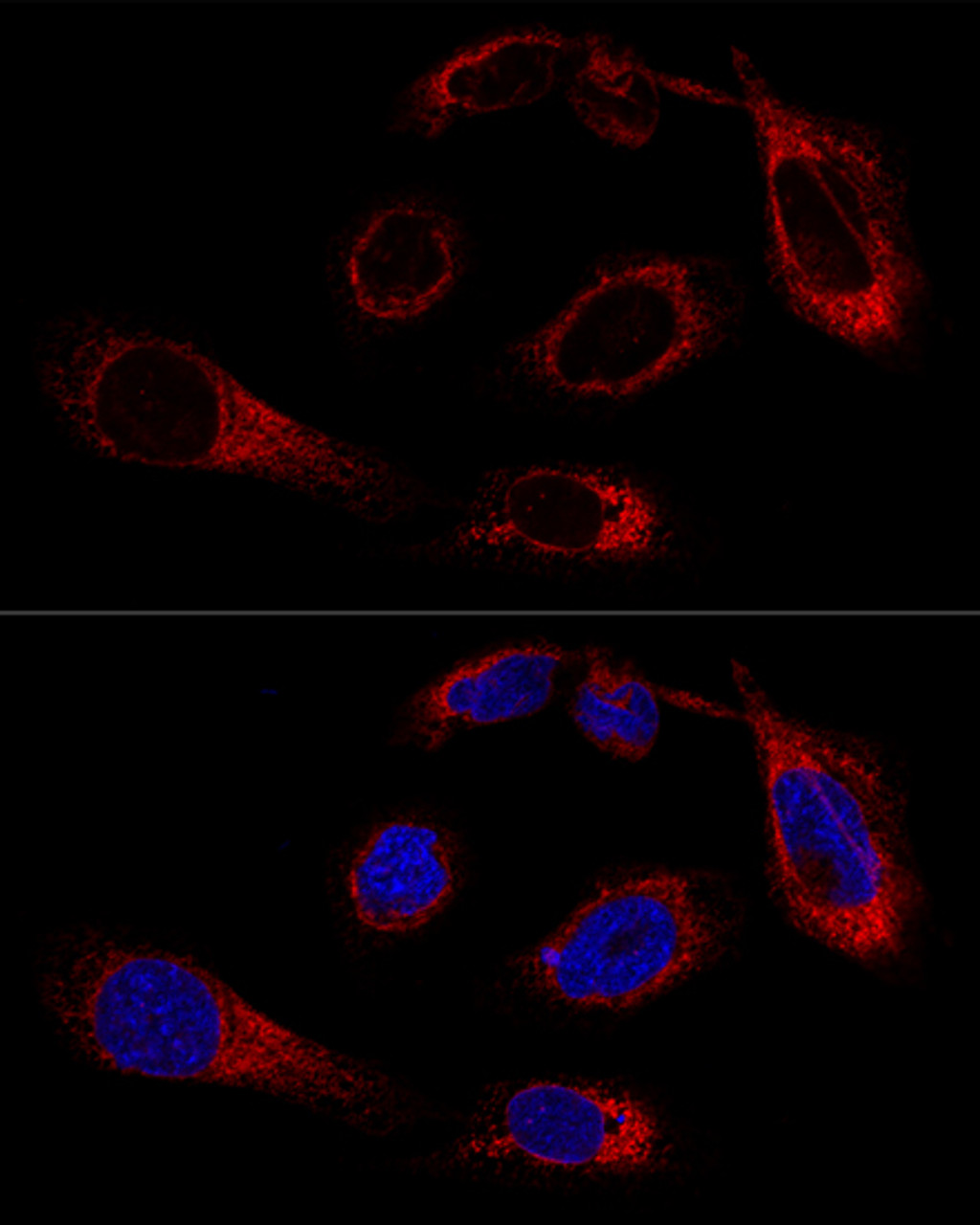 Confocal immunofluorescence analysis of U-2OS cells using GRP78 / BiP Polyclonal Antibody at dilution of  1:200. Blue: DAPI for nuclear staining.