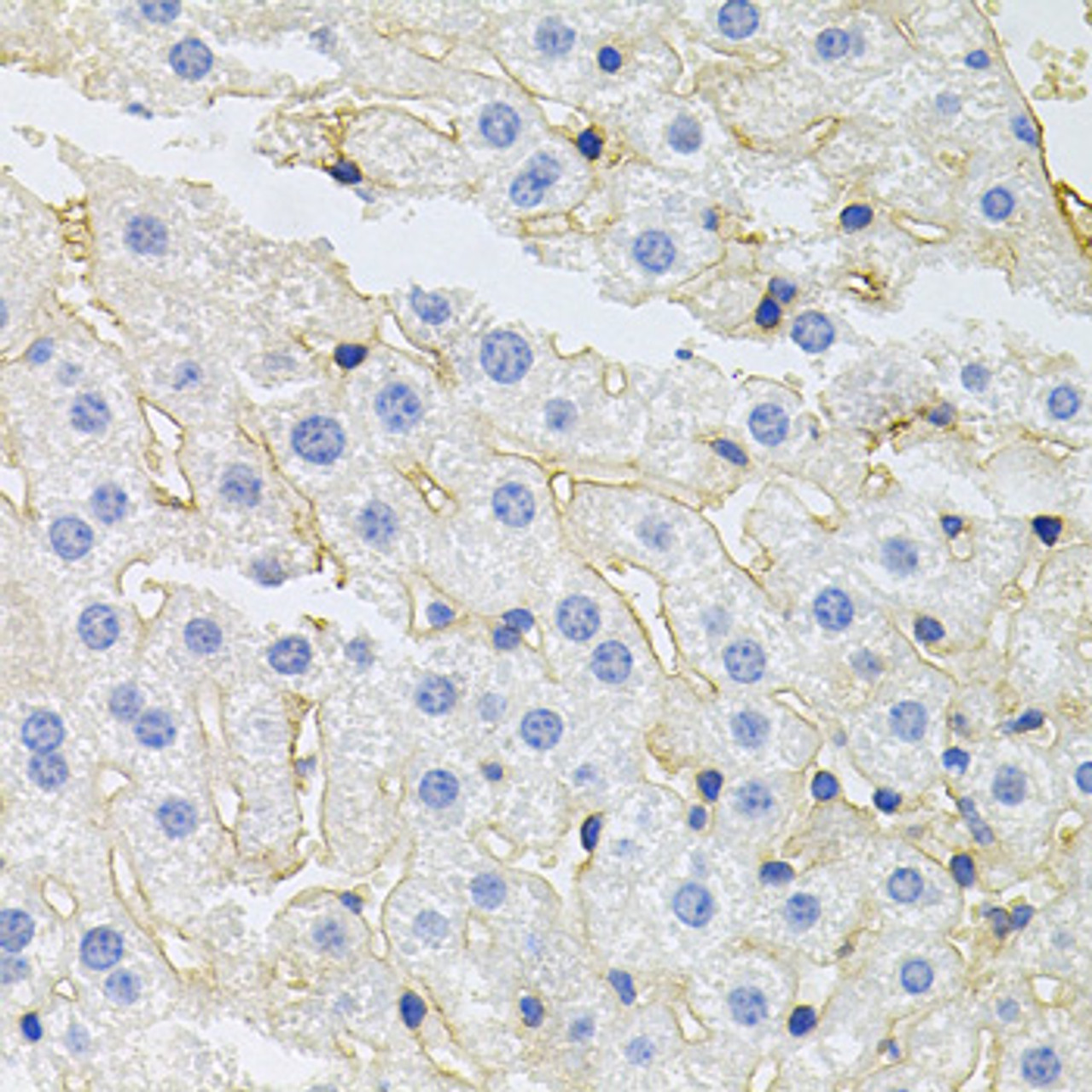 Immunohistochemistry of paraffin-embedded Mouse liver using IGF1R Polyclonal Antibody at dilution of  1:100 (40x lens).