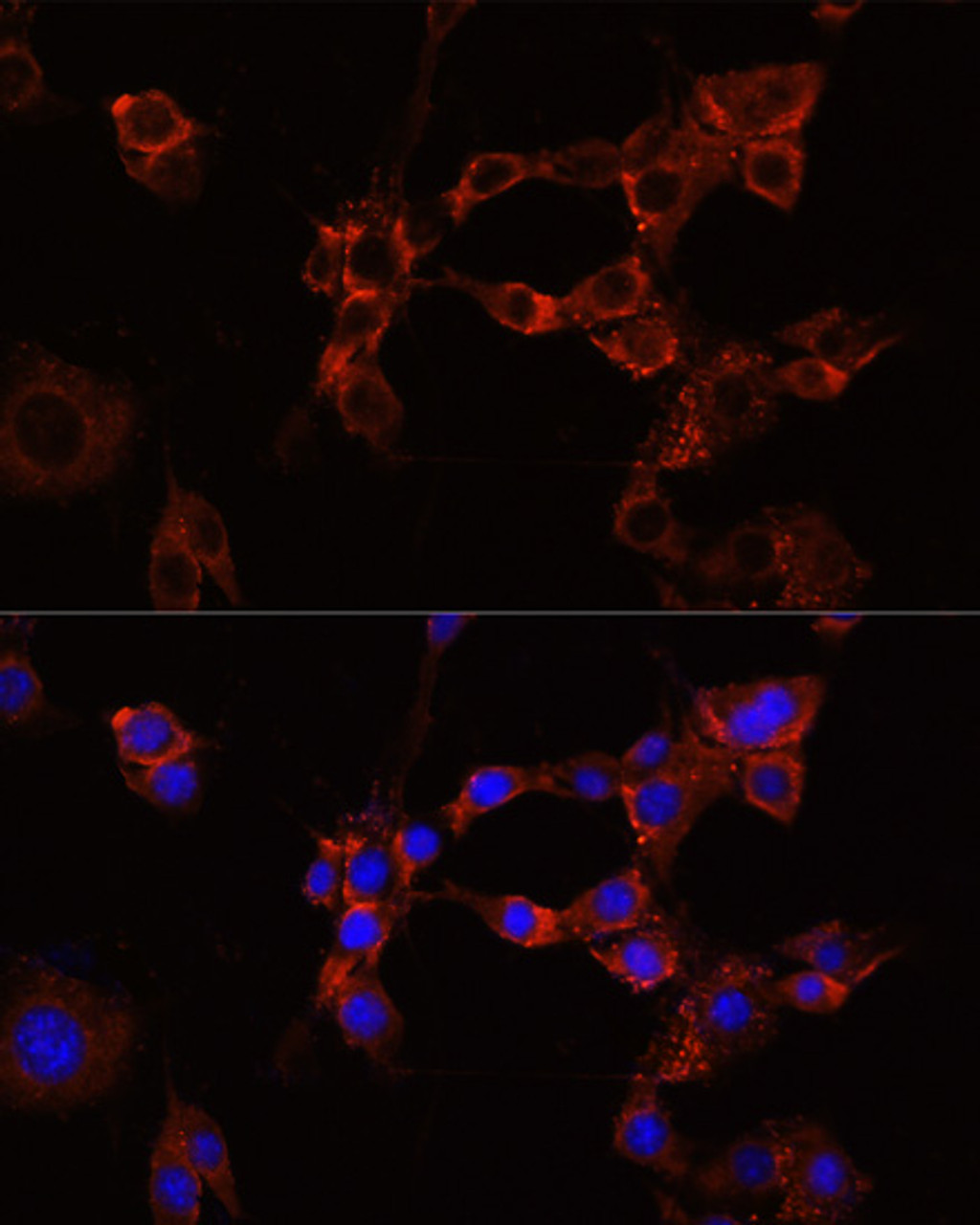 Immunofluorescence analysis of NIH/3T3 cells using IGF1R Polyclonal Antibody at dilution of  1:100 (40x lens). Blue: DAPI for nuclear staining.
