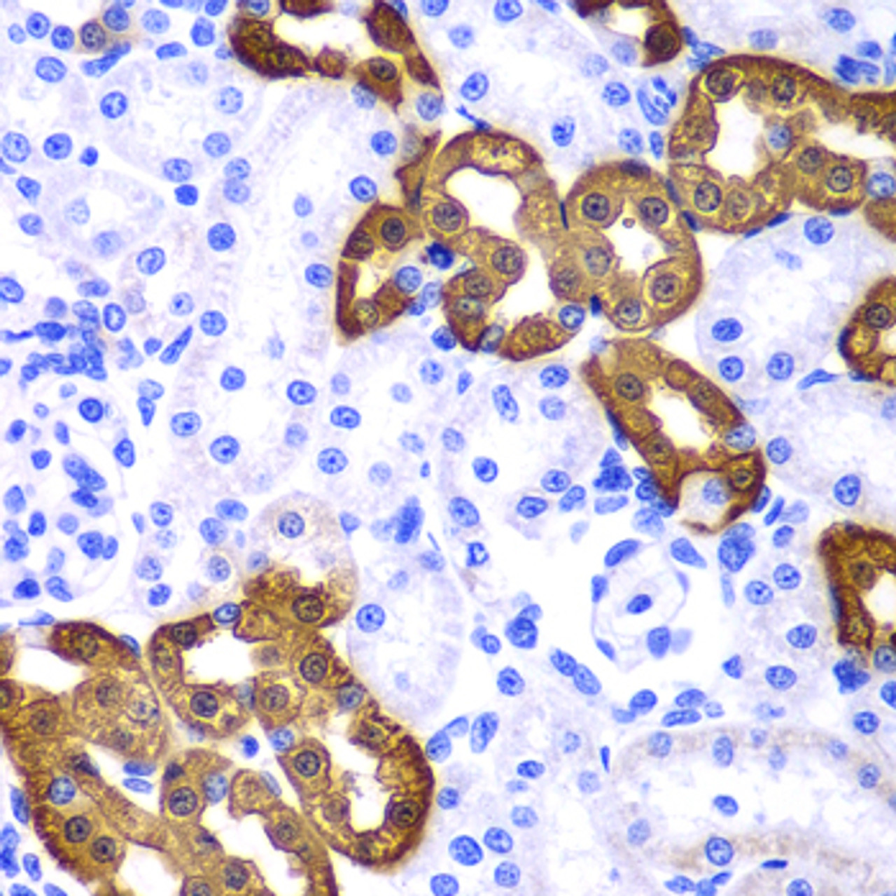 Immunohistochemistry of paraffin-embedded Rat kidney using KRT19 Polyclonal Antibody at dilution of  1:100 (40x lens).