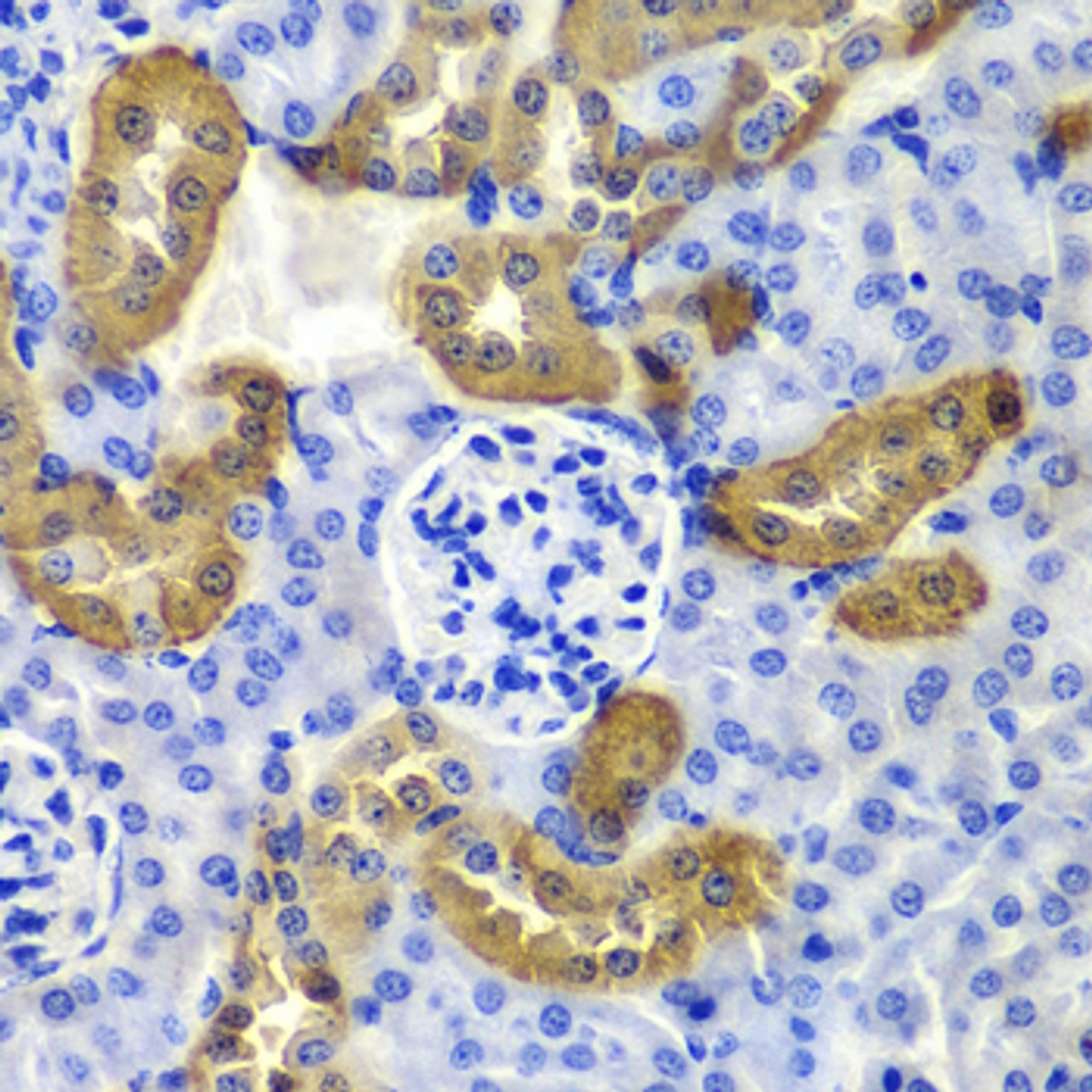 Immunohistochemistry of paraffin-embedded Mouse kidney using KRT19 Polyclonal Antibody at dilution of  1:100 (40x lens).