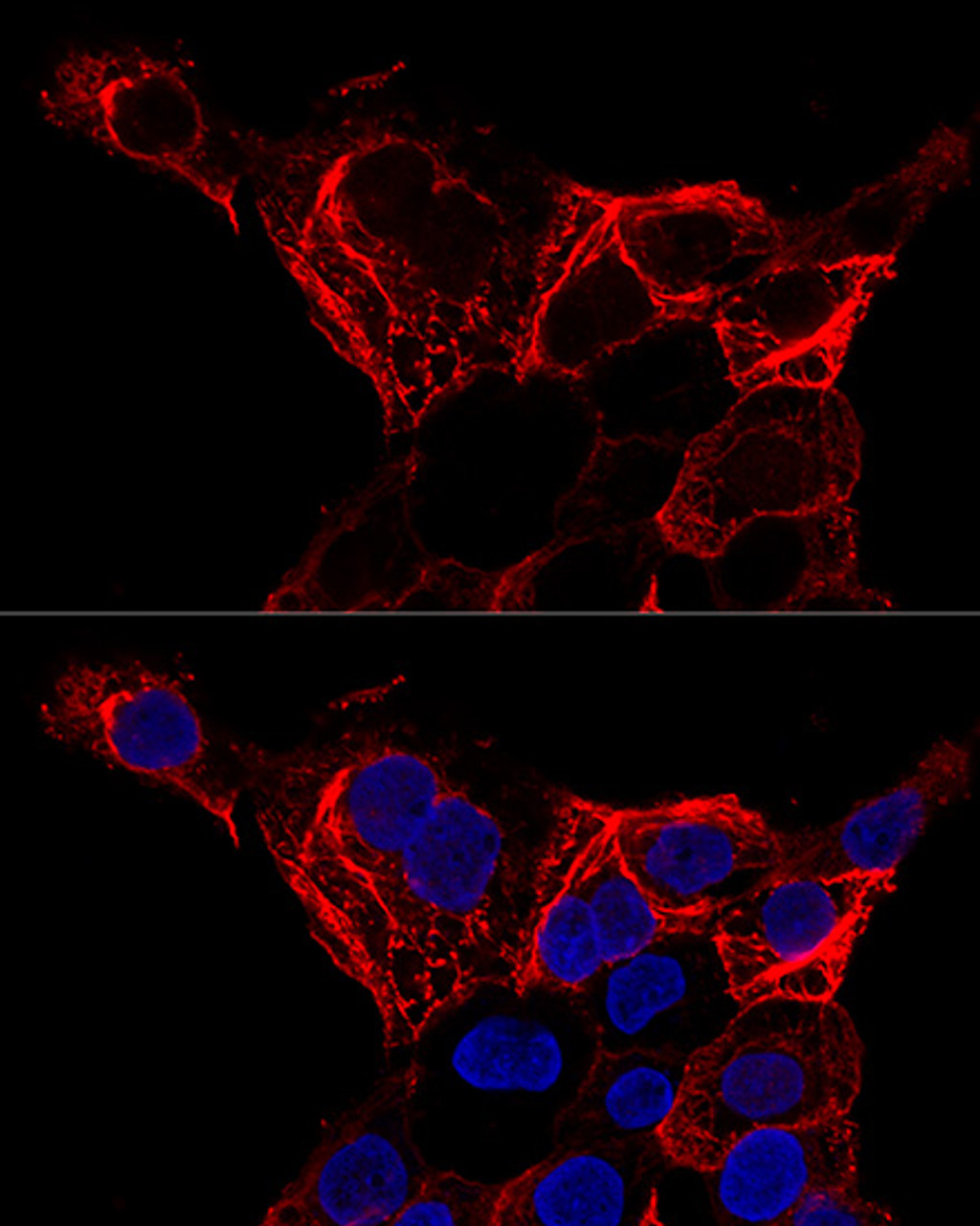 Confocal immunofluorescence analysis of A-431 cells using KRT20 Polyclonal Antibody at dilution of  1:200. Blue: DAPI for nuclear staining.