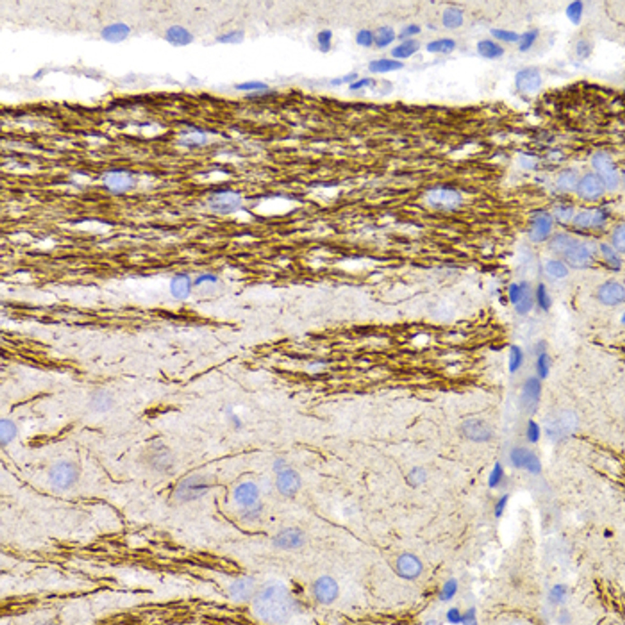 Immunohistochemistry of paraffin-embedded Rat brain using NEFL Polyclonal Antibody at dilution of  1:200 (40x lens).