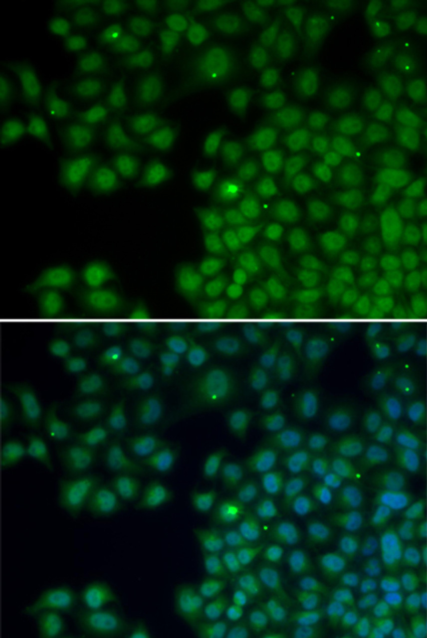 Immunofluorescence analysis of HeLa cells using NUDT6 Polyclonal Antibody