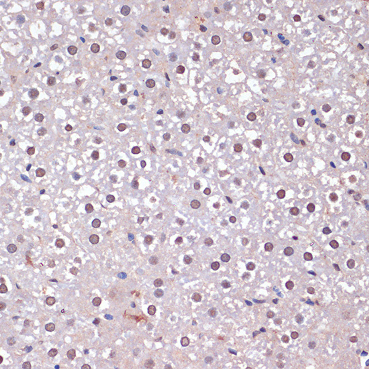 Immunohistochemistry of paraffin-embedded Rat liver using CDKN2A / p16INK4a Polyclonal Antibody at dilution of  1:100 (40x lens).