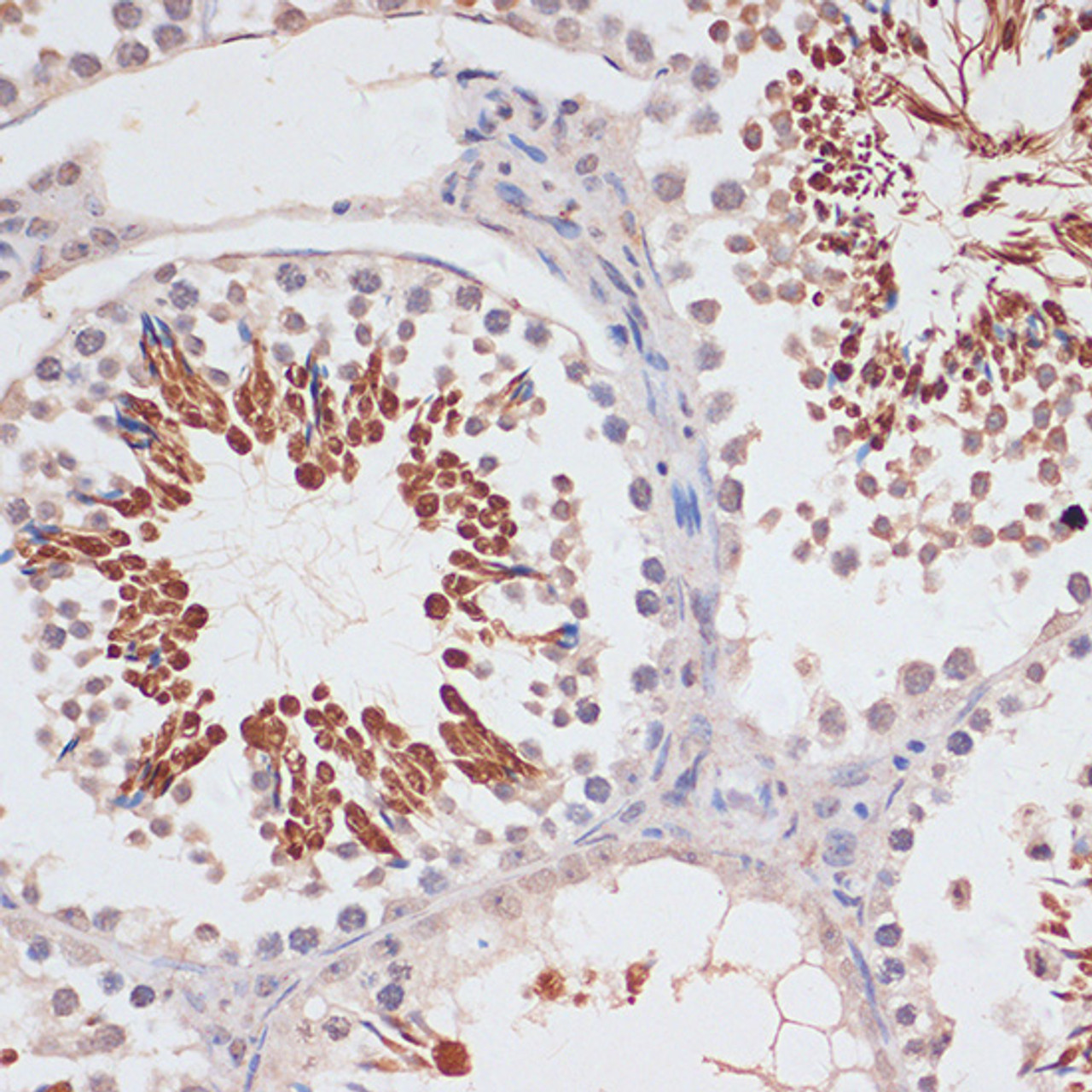 Immunohistochemistry of paraffin-embedded Mouse testis using CDKN2A / p16INK4a Polyclonal Antibody at dilution of  1:100 (40x lens).