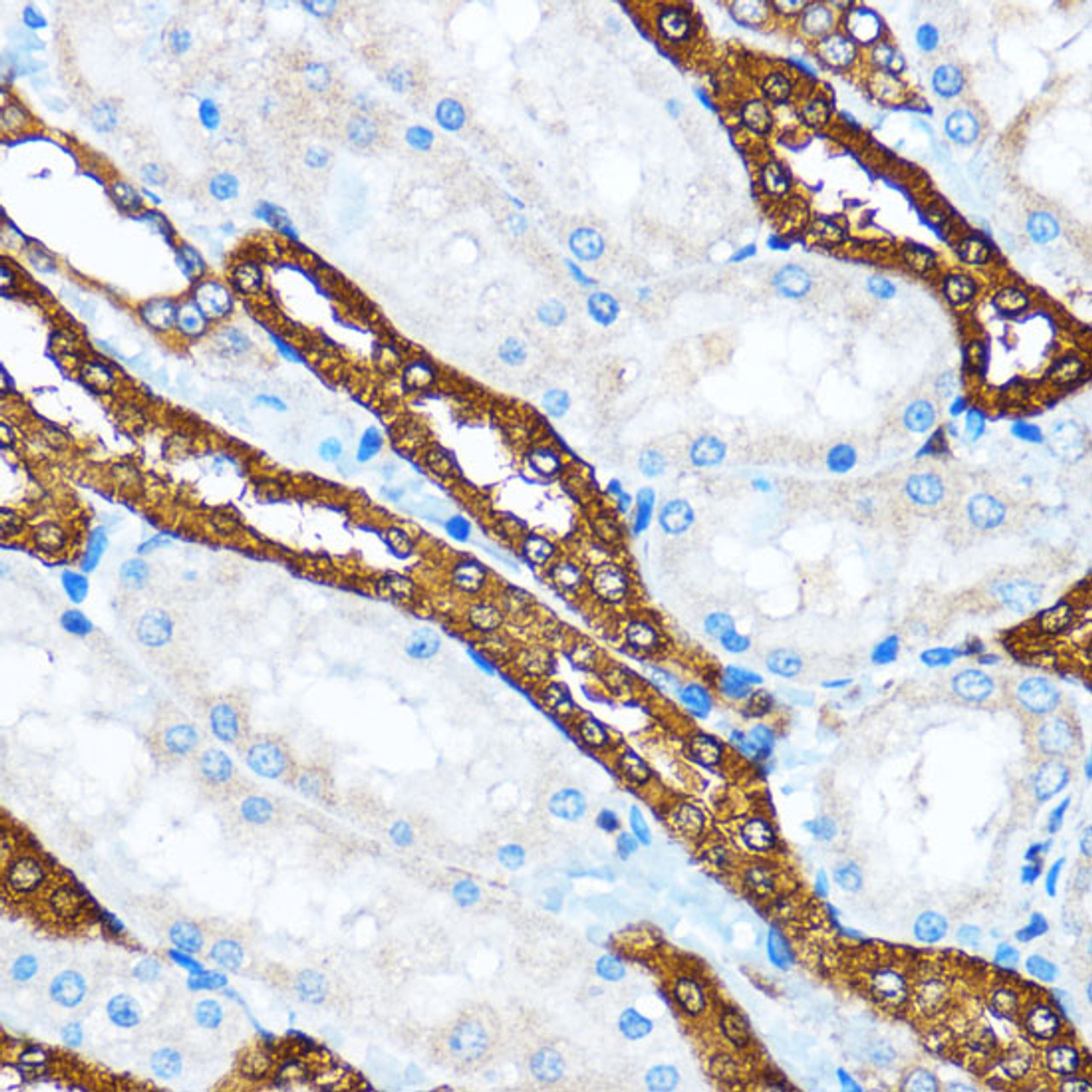 Immunohistochemistry of paraffin-embedded Rat kidney using PIK3CA Polyclonal Antibody at dilution of  1:100 (40x lens).