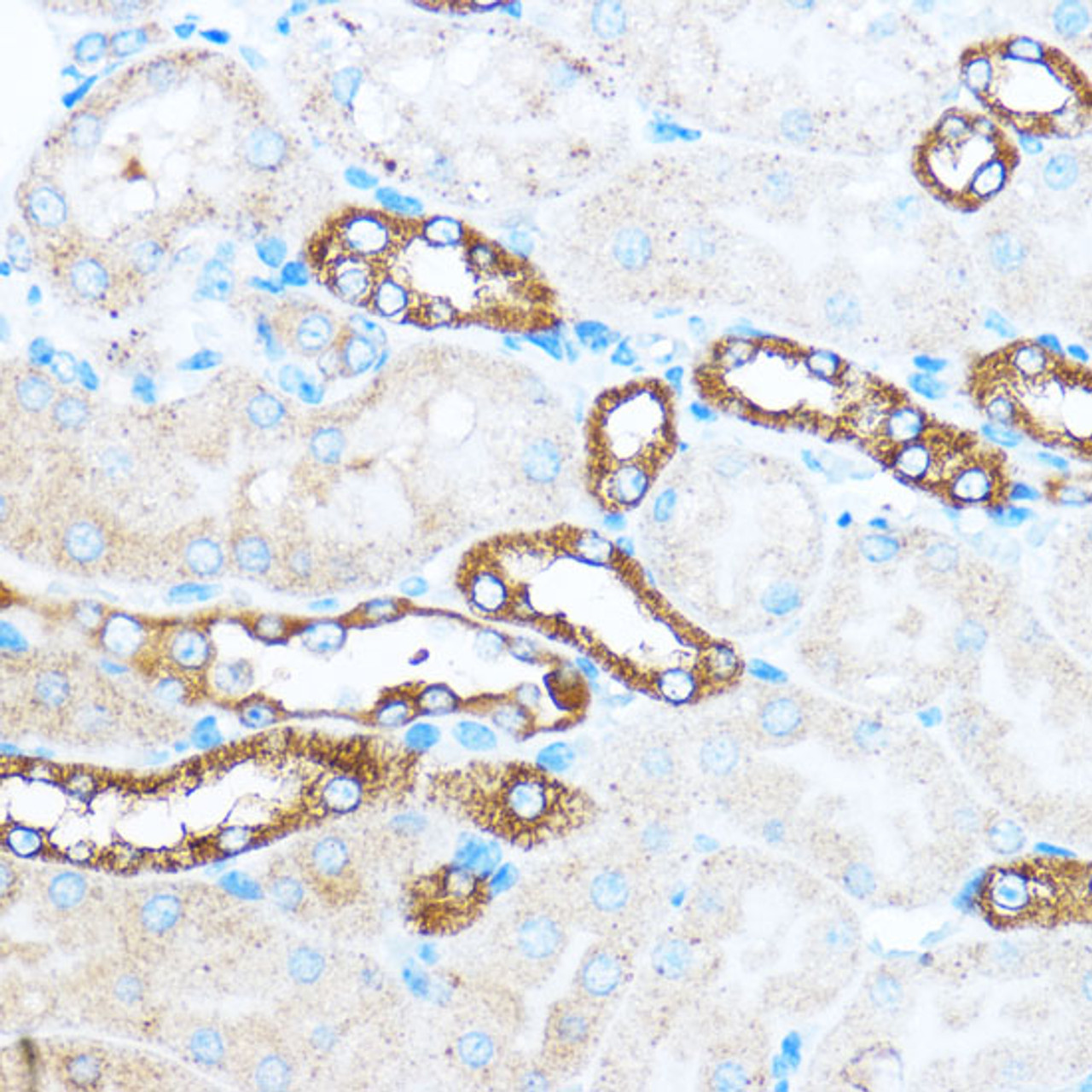 Immunohistochemistry of paraffin-embedded Mouse kidney using PIK3CA Polyclonal Antibody at dilution of  1:100 (40x lens).