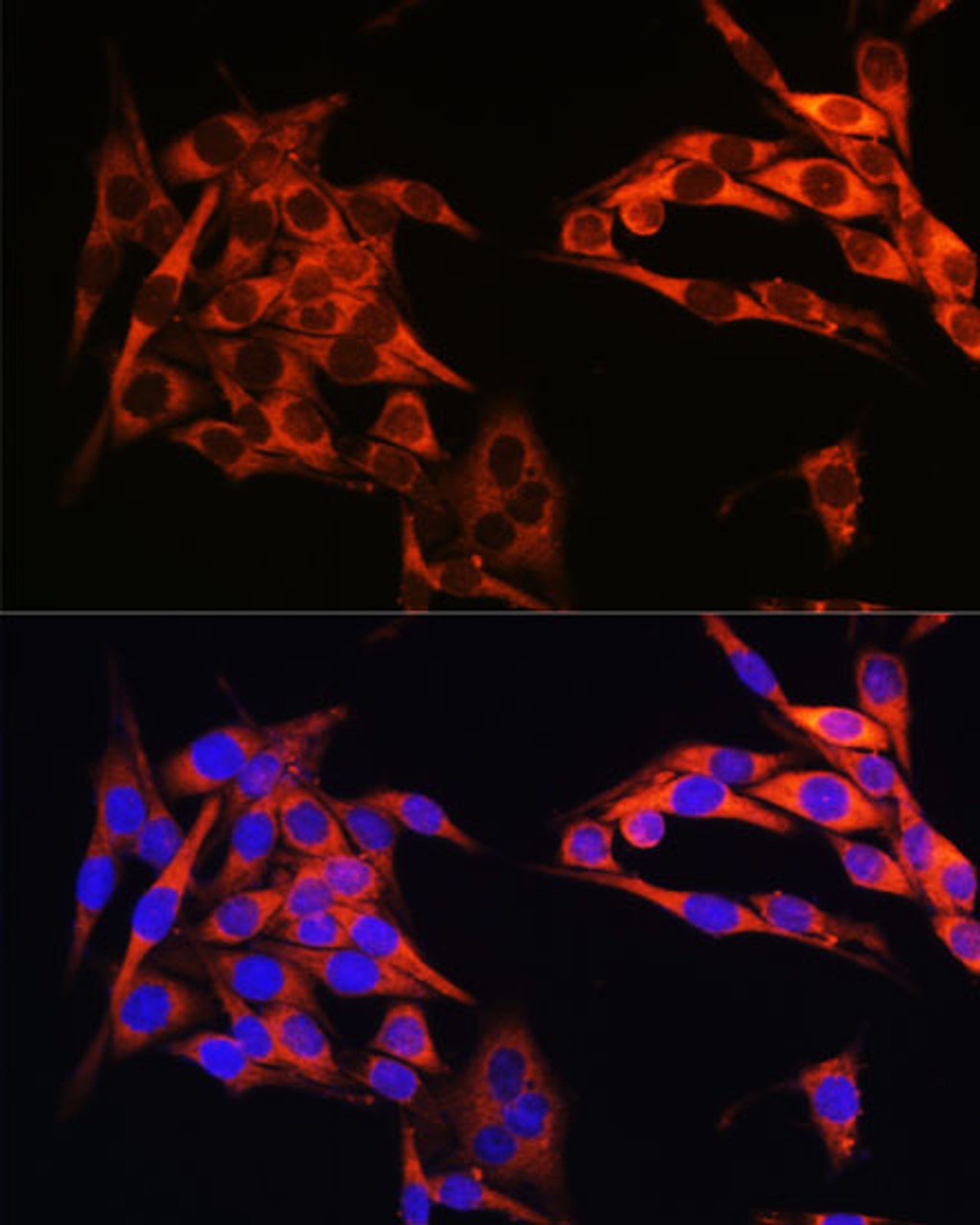 Immunofluorescence analysis of HeLa cells using PIK3CA Polyclonal Antibody at dilution of  1:100. Blue: DAPI for nuclear staining.