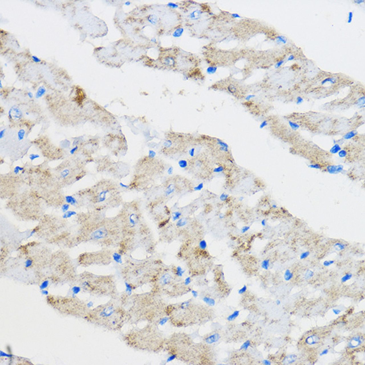 Immunohistochemistry of paraffin-embedded Rat heart using PPAR gamma Polyclonal Antibody at dilution of  1:100 (40x lens).