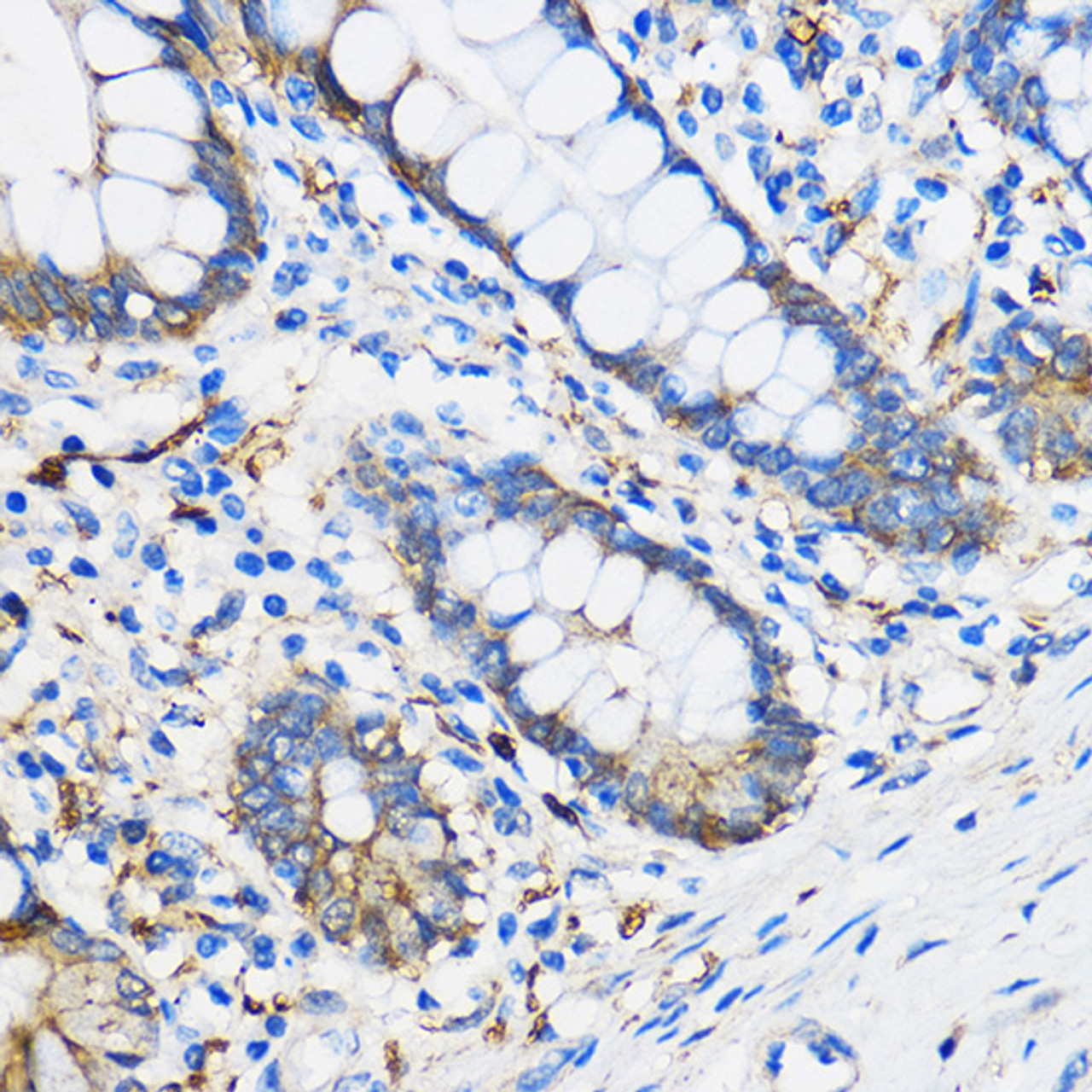 Immunohistochemistry of paraffin-embedded Human colon using PPAR gamma Polyclonal Antibody at dilution of  1:100 (40x lens).