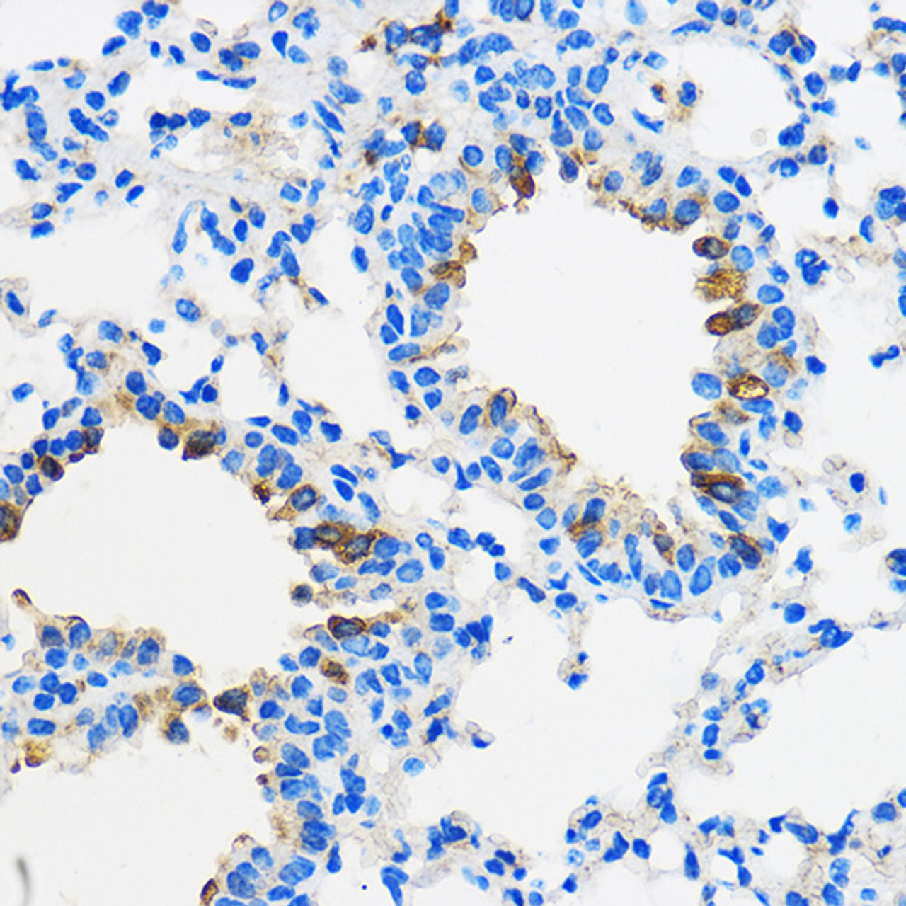 Immunohistochemistry of paraffin-embedded Mouse lung using PPAR gamma Polyclonal Antibody at dilution of  1:100 (40x lens).
