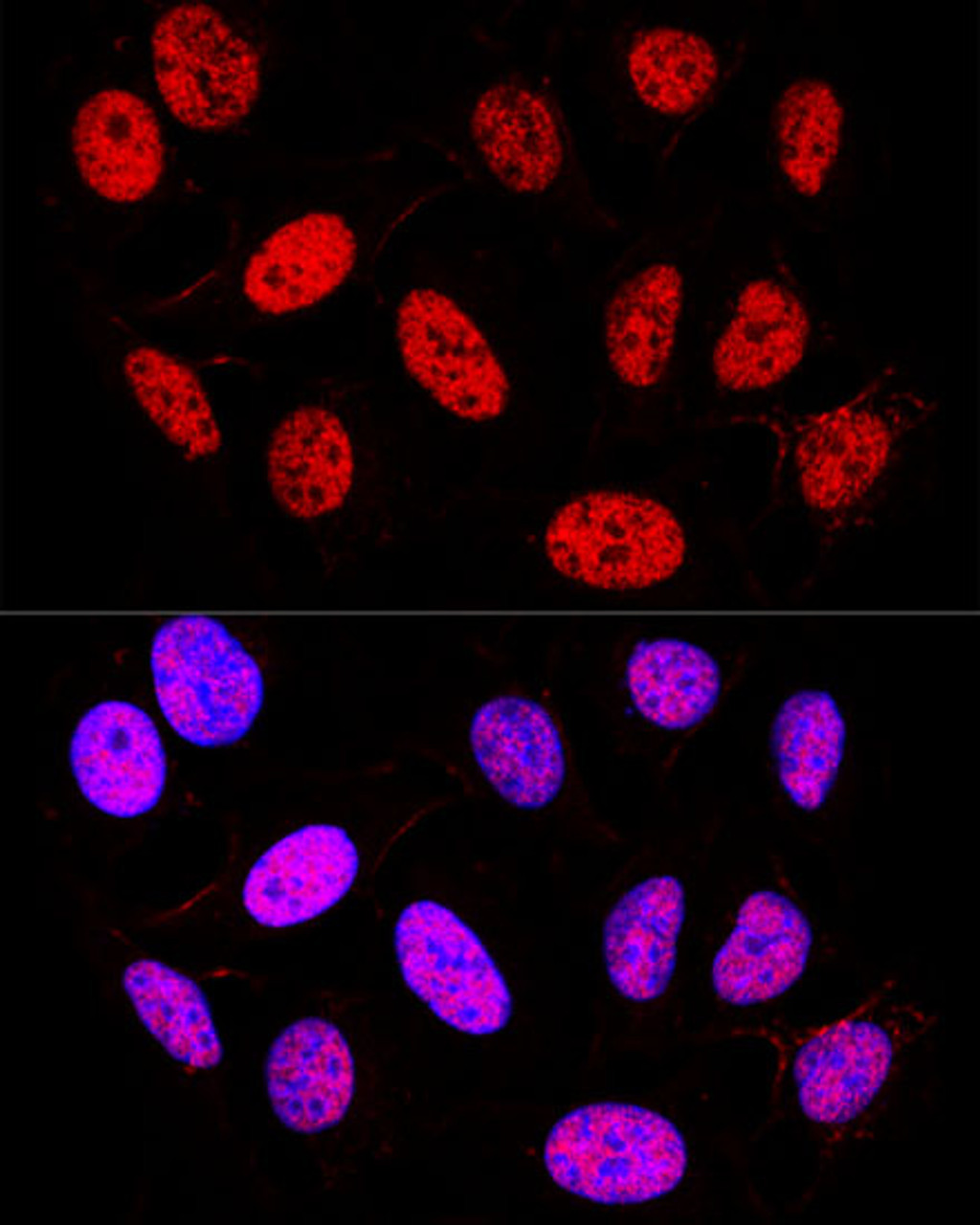 Confocal immunofluorescence analysis of U-2 OS cells using PPAR gamma Polyclonal Antibody at dilution of  1:200. Blue: DAPI for nuclear staining.